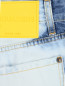 Укороченные джинсы из хлопка с узором Dsquared2  –  Деталь