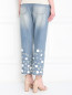 Укороченные джинсы с декоративной аппликацией Michael by Michael Kors  –  МодельВерхНиз1