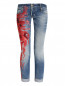 Укороченные джинсы с декоративной отделкой Dsquared2  –  Общий вид