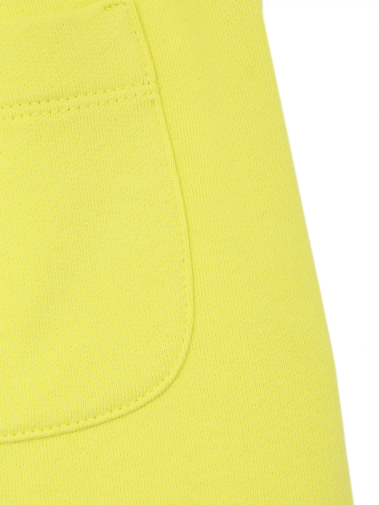 Шорты из трикотажа с карманами MSGM  –  Деталь1  – Цвет:  Желтый