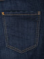 Укороченные джинсы на пуговицах Dsquared2  –  Деталь