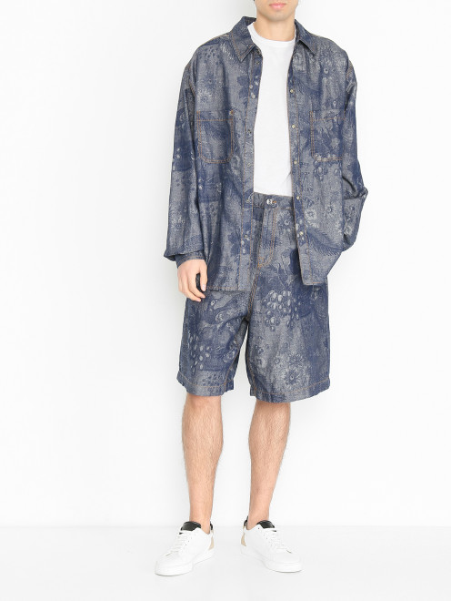 Шорты из хлопка и льна с узором Etro - МодельОбщийВид