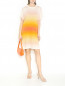 Трикотажное платье с узором полоска Sonia Rykiel  –  МодельОбщийВид