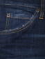 Укороченные джинсы на пуговицах Dsquared2  –  Деталь2
