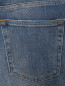 Укороченные джинсы с потертостями Diesel  –  Деталь2