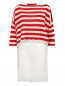Платье мини  + джемпер в полоску  из шерсти и шелка декорированные кружевом Ermanno Scervino  –  Общий вид