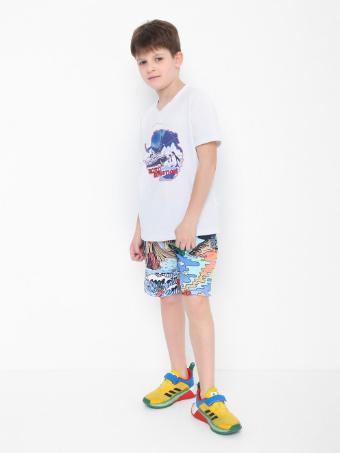 Хлопковые шорты с карманами Little Marc Jacobs - МодельОбщийВид
