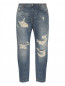 Укороченные джинсы с потертостями My Twin  –  Общий вид