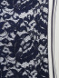 Платье-мини с узором "полоска" и декоративной отделкой из кружева Antonio Marras  –  Деталь1