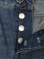 Укороченные джинсы с потертостями My Twin  –  Деталь2