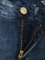 Укороченные джинсы из хлопка с фурнитурой My Twin  –  Деталь1